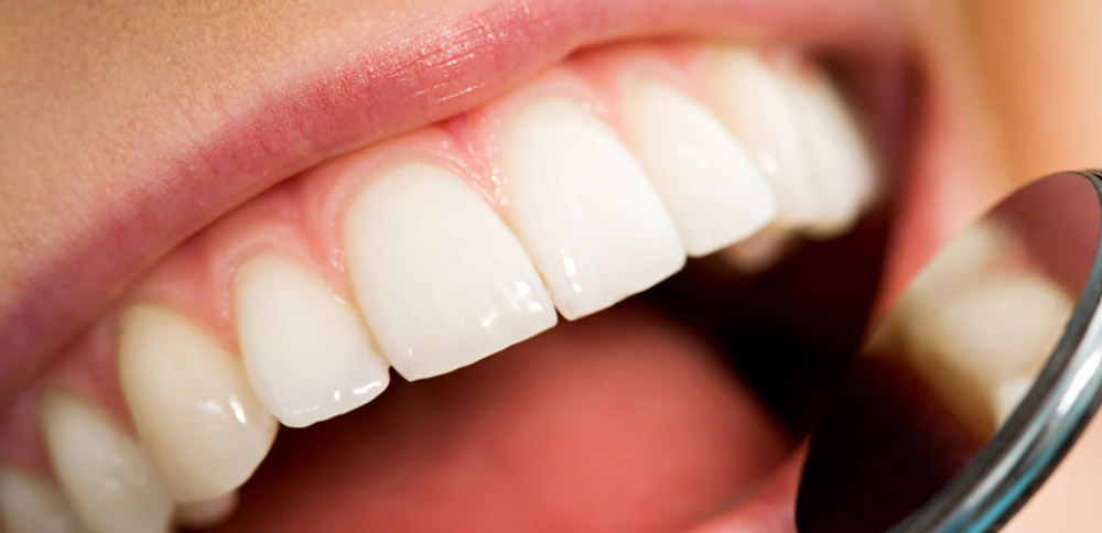 Aligner: Effektive Behandlungsmethode für Erwachsene und Jugendliche, wenn der Fokus auf Ästhetik liegt.
